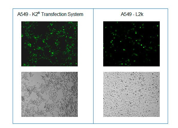 Microscopy after transfection of A549 cells with K2® Transfection System and L2k
