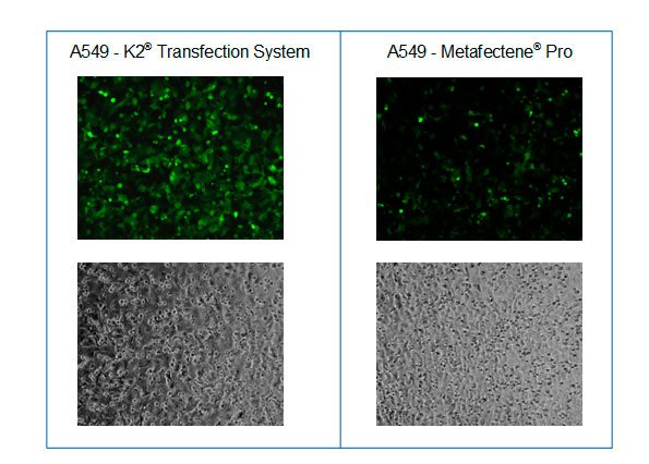 Microscopy after transfection of A549 cells with GFP encoding mRNA and K2® Transfection System compared to METAFECTENE® PRO