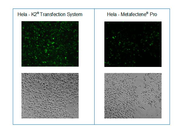 Microscopy after transfection of HeLa cells with GFP encoding mRNA and K2® Transfection System compared to METAFECTENE® PRO
