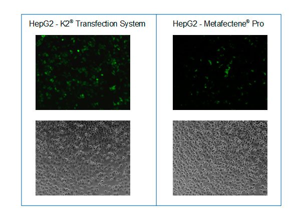 Microscopy after transfection of HepG2 cells with GFP encoding mRNA and K2® Transfection System compared to METAFECTENE® PRO