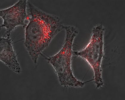 Transfected cells using METAFECTENE® FluoR and pCMV-eGFP