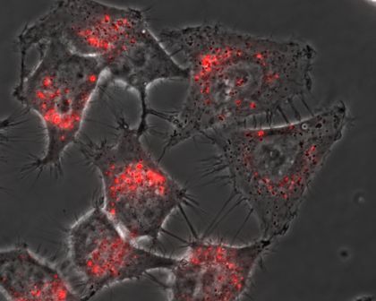 Transfected cells using METAFECTENE® FluoR and pCMV-eGFP