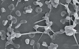 Electron microscope image of mycoplasma colony on cell surface