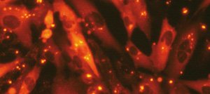 Proteofection of BEAS-2B cells with R-phycoerythrin and PROTEOfectene®