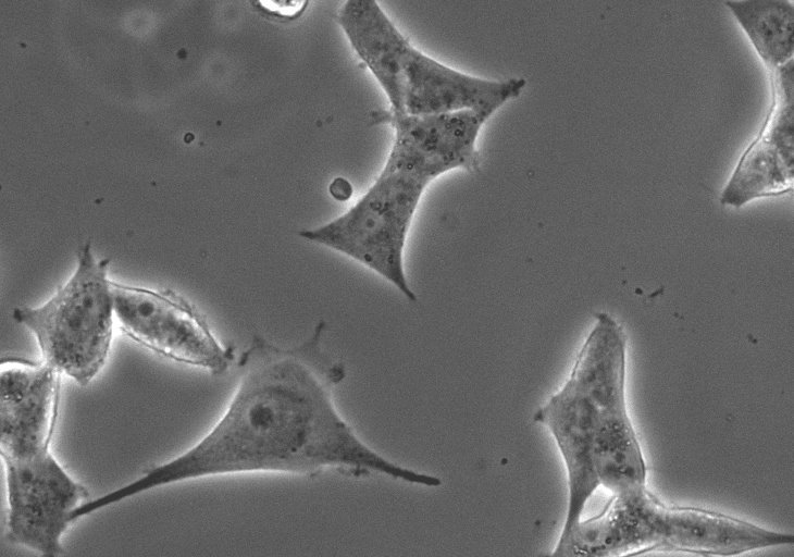 Light image after proteofection of HeLa cells with GST-NLS-GFP protein