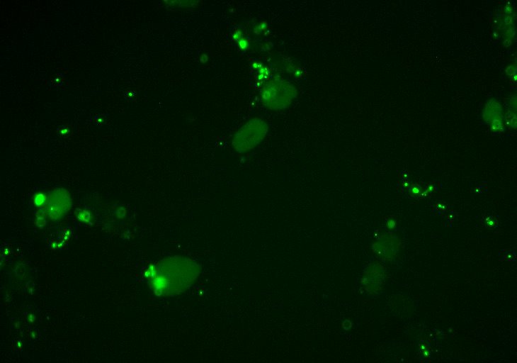 Fluorescence image after proteofection of HeLa cells with GST-NLS-GFP protein