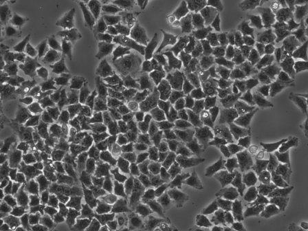 Light image after proteofection of HepG2 cells with R-phycoerythrin