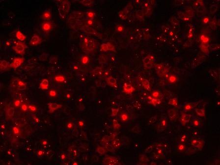 Fluorescence image after proteofection of HepG2 cells with R-phycoerythrin